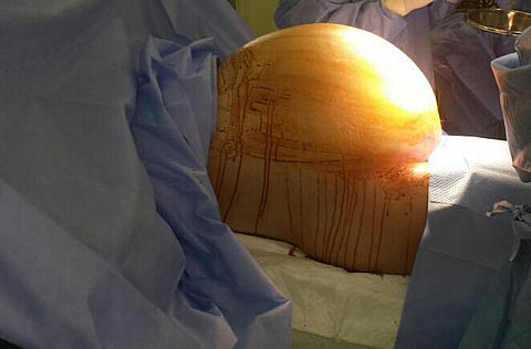 Courtesy: Al Qassimi Hospital