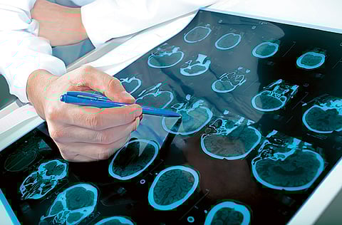 There is a defined process to test patients for Covid-19