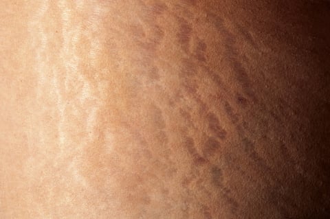 Getty Images/iStockphoto