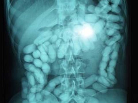 A drug consignment. For representational purpose only.