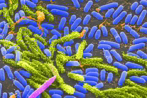 University of Hawaii at Manoa