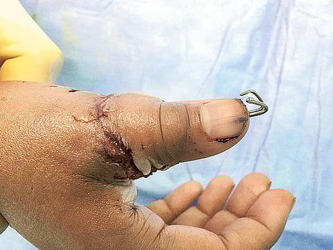 Courtesy: Rashid Hospital