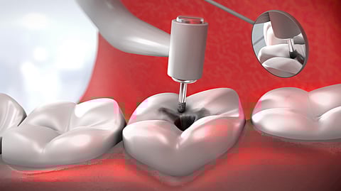 Getty Images/iStockphoto