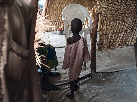 A malnourished boy walking towards his mother at one of the Unicef nutrition clinics in northeastern Nigeria.