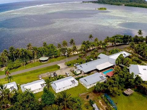 Courtesy: wintheislandestates.com