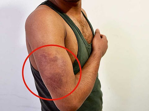 Virendra Saklani/XPRESS