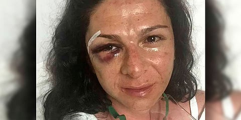 Social media condemns violence against women