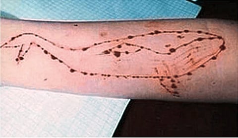 Courtesy Social Media