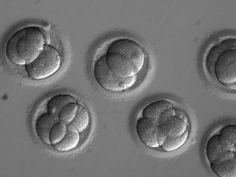 In this photo provided by Oregon Health & Science University, taken through a microscope, human embryos grow in a laboratory for a few days after researchers used gene editing technology to successfully repair a heart disease-causing genetic mutation.