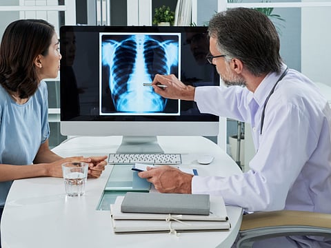 Lung cancer screening to become routine for heavy smokers