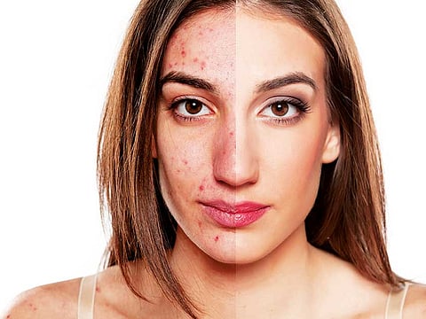 Getty Images/iStockphoto