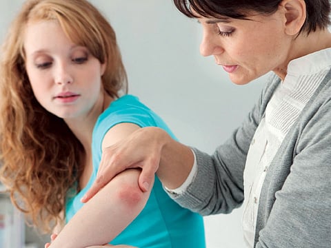 Patients with psoriasis need a thorough assessment to detect any manifestation of the condition on other organs