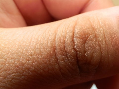 Image for illustrative purposes only