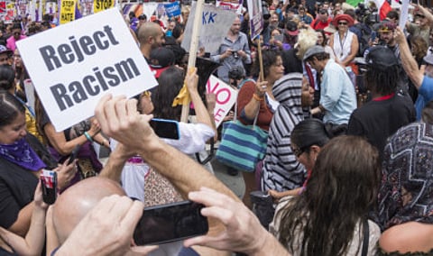 Nobody wants racism to exist. But, it does — in those looks, nudges, rolling of eyes, those whispers and brute physical force