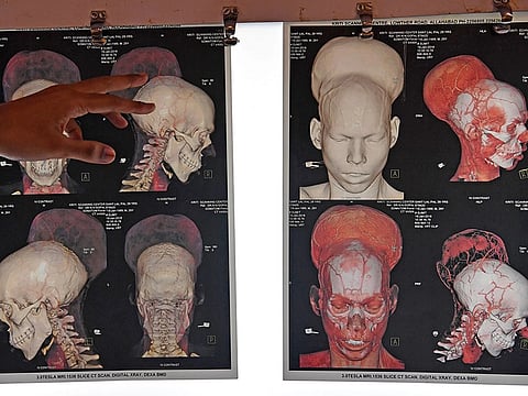 Indranil Mukherjee/AFP/Getty