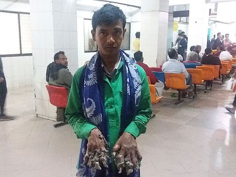 Abul Bajandar (C), dubbed as Bangladeshi tree man, returns to a Dhaka hospital on January 21, 2019, as bark-like growths on his hand keep increasing.
