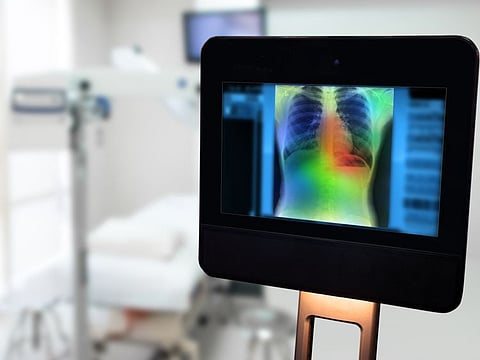 Algorithms have been designed to help detect pneumothorax, or collapsed lungs, in chest X-rays with high accuracy