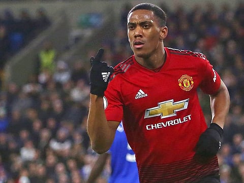 France striker Anthony Martial is back in training for Man Utd.