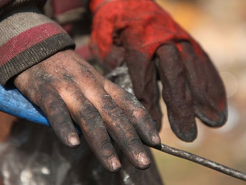 A displaced Syrian child shows his dirty hands at a landfill outside a camp in Kafr Lusin near the border with Turkey