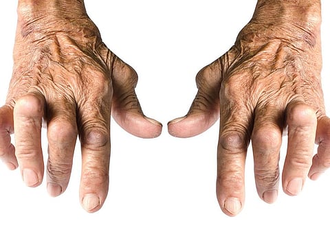 What does it feel like to have arthritis?