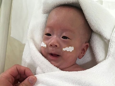 Smallest baby in the world