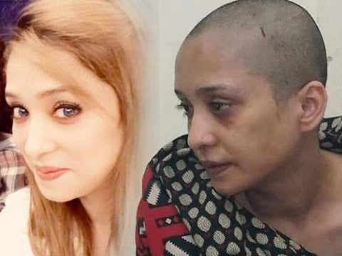 Pakistani man who tortured wife for refusing to dance remanded to police custody