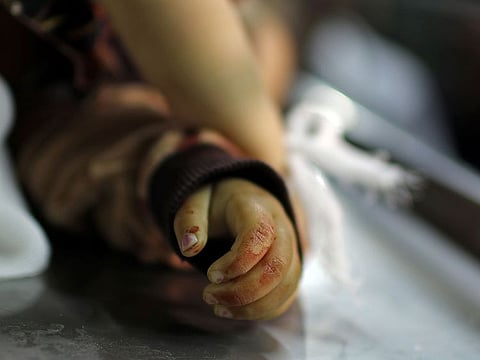 The body of 14-month old Palestinian baby Seba Abu Arar is seen at a hospital morgue in Gaza City May 4, 2019.