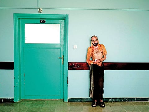 A survivor of torture in an Al Houthi prison.