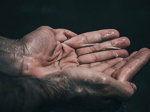 Some people face embarrassment due to excessively sweating hands