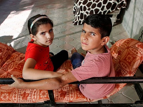 Palestinian brothers Yamen and his sester Jana Abo-Hamda show his hand wounded in 2014. picture taken on August 21, 2019. In the summer of 2014, during a war between the Gaza militants of Hamas, the Islamist and the Israeli military, an Israeli plane dropped a bomb on a building where Yamin's family had gathered in the centre of the Gaza Strip. In an instant, 19 people were killed, including six children. Yamin, just three at the time, and his sister Gayna, only several months old, survived. But they are orphans.