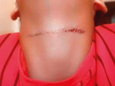 Mother raises warning against danger of hold breathing challenges game. Her son, aged 13, survived after he was playing this game.