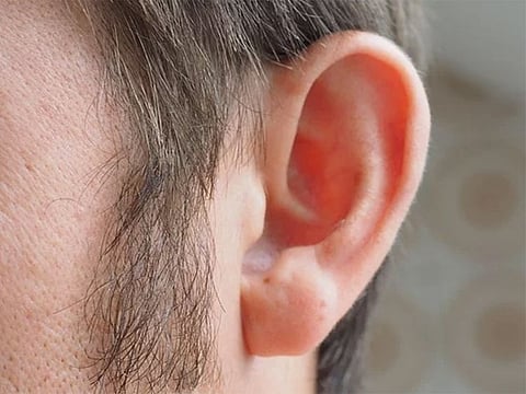 For illustrative purposes only