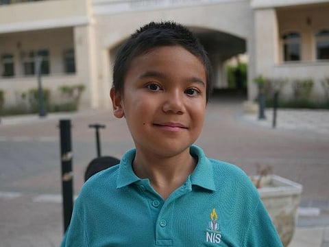 The mother of a 10-year-old boy Kyrgyz boy, diagnosed with a rare congenital disease, is in search for help.