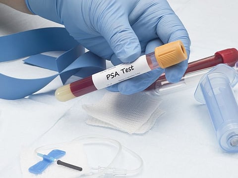 November ends but prostate cancer concerns remain