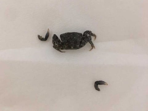 Abu Dhabi expat L.E. was shocked to discover that a baby crab had entered his right ear while he was at the beach.