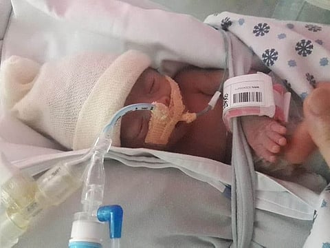 Baby: Sharee, born premature at six months and two weeks at Latifa Hospital in Dubai
