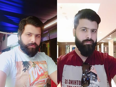 Ahmed before (left) and after