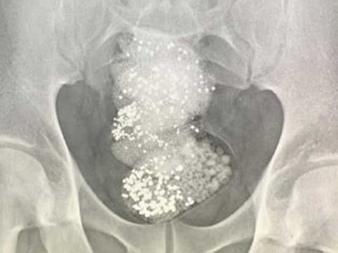 A man was held at Sharjah International Airport for attempting to smuggle 297 grams of raw diamonds worth around Dh330,000.