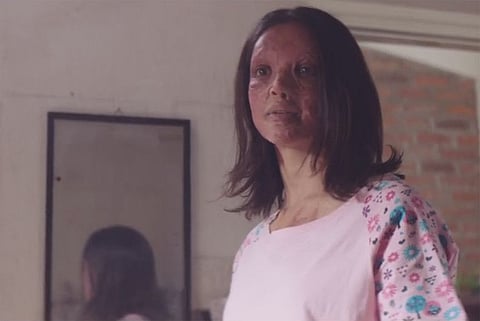 Deepika’s ‘Chhapaak’ leads to new scheme for acid attack survivors