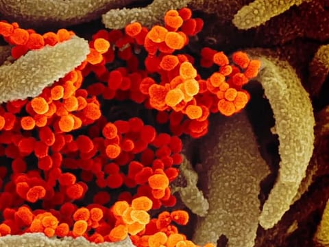 U.S. National Institute of Allergy and Infectious Diseases