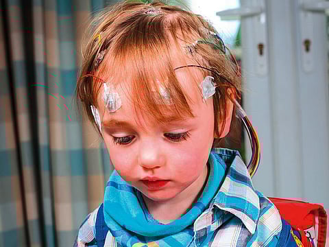While most neurological diseases are found in all age groups they sometimes present themselves differently in children