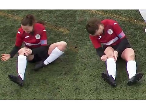 A football player punched her dislocated knee in place