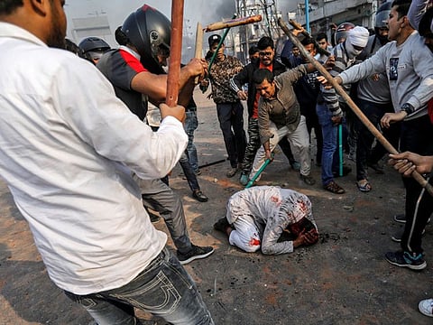 Delhi: Mohammad Zubair was grievously injured after being beaten by a group of men during protests sparked by India's new citizenship law