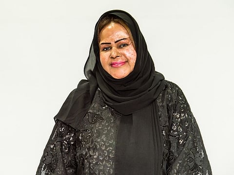 Rafiya who suffered burns in an incense accident