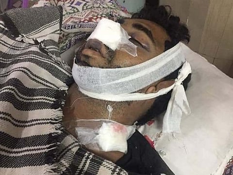 Saleem Masih succumbed to his injures after being tortured in Kasur, Pakistan