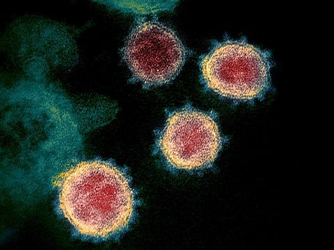 Scientists point to RNA “folding” within SARS-CoV-2 genome, to help explain how the coronavirus became so virtually unstoppable after it reportedly spilled over from bats to humans.