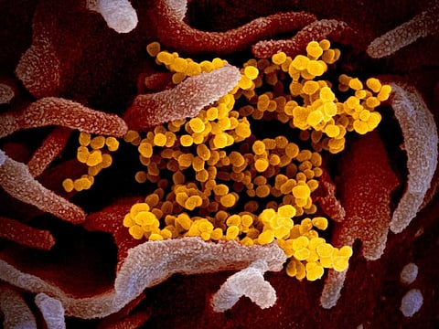 This undated electron microscope image made available by the U.S. National Institutes of Health in February 2020 shows the Novel Coronavirus SARS-CoV-2, yellow, emerging from the surface of cells, pink, cultured in the lab. Also known as 2019-nCoV, the virus causes COVID-19. The sample was isolated from a patient in the U.S. On Thursday, March 5, 2020, Tennessee's Department of Health Commissioner Lisa Piercey confirmed the state's first case of the new coronavirus. (NIAID-RML via AP)