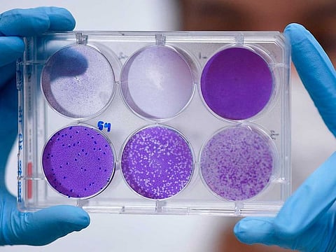 A researcher works on virus replication in order to development a vaccine against the coronavirus Covid-19, in Belo Horizonte, state of Minas Gerais, Brazil, on March 26, 2020. The World Health Organisation says it’s important to know whether the BCG vaccine can reduce disease in those infected with the coronavirus.