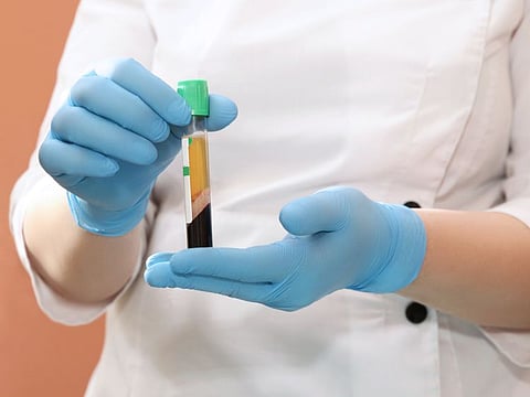 Blood plasma from recovered patients could be used to help those still struggling with coronavirus