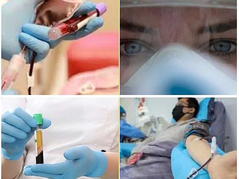 Convalescent Plasma Therapy